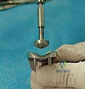 دكتور محمد هطيف في غرفة العمليات