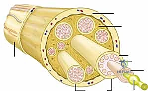 Illustration of sutures are placed - Dr. Mohammed Hutaif