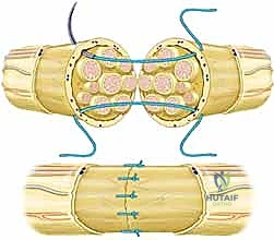 أدوات الجراحة الميكروسكوبية الدقيقة