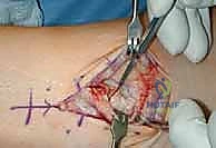 استخدام أحدث التقنيات في تشخيص حالة الكاحل