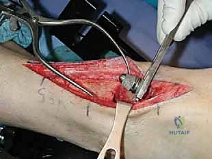 تقييم الخيارات العلاجية مع المريض في صنعاء