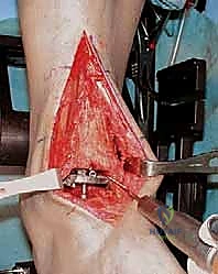 الفحص السريري لتشوهات مفصل الكاحل في عيادة الدكتور محمد هطيف