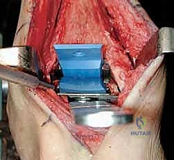 استخدام التقنيات الحديثة في غرفة العمليات بصنعاء