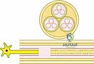 تحرير العصب الداخلي - خطوة 2