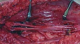 مرحلة التأهيل والعلاج الطبيعي