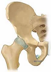خطوات قطع عظم الإسك والعانة
