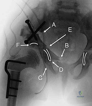 المتابعة الدورية في العيادة لضمان نجاح الجراحة
