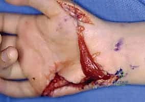 الفحص السريري لتشخيص شلل العصب الأوسط