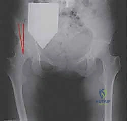 Illustration of level v evidence - Dr. Mohammed Hutaif