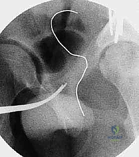 فحص المريض وتقييم نطاق الحركة