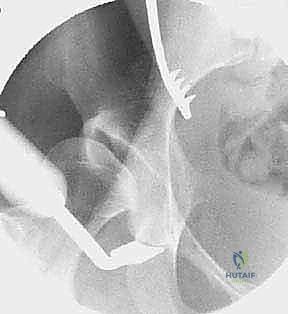 توضيح مسارات الأعصاب والأوعية الدموية حول المفصل