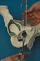 النهج الجراحي والشق الأولي