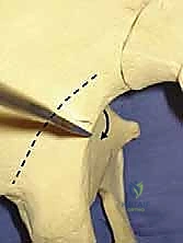 مقارنة بين المفصل الطبيعي والمفصل الصناعي