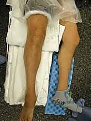 تخطيط ما قبل الجراحة