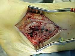 استخدام تقنية المنظار 4K