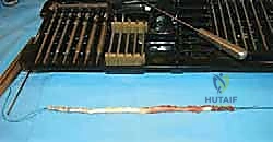 صورة طبية: مراجعة مفصل الكاحل الصناعي (Agility) وعلاج كسور الكعب: دليل شامل للمرضى