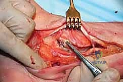 الدكتور هطيف أثناء تقييم الأشعة