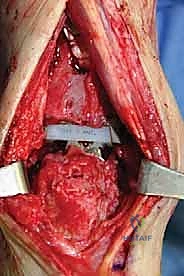 مراجعة الأشعة السينية أثناء العملية