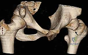 التخطيط الجراحي ثلاثي الأبعاد