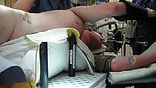 التشريح الدقيق لمفصل الورك والتروية الدموية