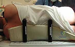 إجراء الشق العظمي للمدور الكبير