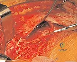 دقة استخدام الأدوات الجراحية الحديثة