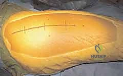 تثبيت المدور الكبير بالبراغي