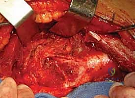 تمارين تقوية عضلات الحوض