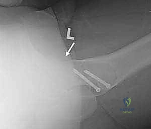 تقييم استجابة المريض للعلاج التحفظي