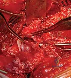 تجهيز المريض في غرفة العمليات