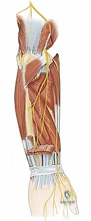 فحص المريض وتحديد مدى تلف العصب الكعبري