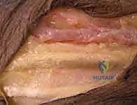 البروفيسور محمد هطيف أثناء التقييم الدقيق لحالة المريض