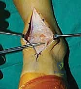 الأشعة السينية للكاحل