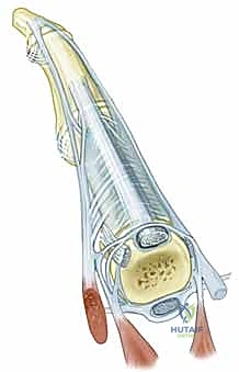 توضيح الأربطة والمثبتات الثابتة لمفصل MCP