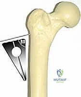 فحص المدى الحركي والأعراض السريرية