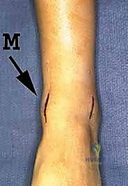 تشريح مفصل الكاحل والغضاريف