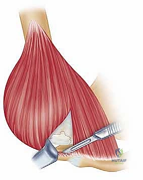 تشريح مفصل الكتف وأوتار الكفة المدورة