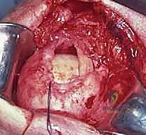 التأكد من متانة الخياطة وقوة الشد