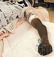 التخطيط الجراحي قبل العملية