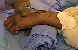 تجهيز المريض في غرفة العمليات