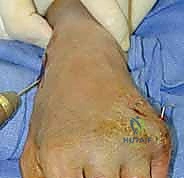 صورة شعاعية حية تظهر محاذاة العظام