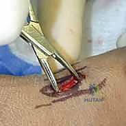 إدخال السلك الثاني لزيادة الاستقرار