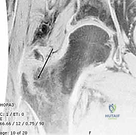 تجهيز المريض وتحديد موقع الكسر