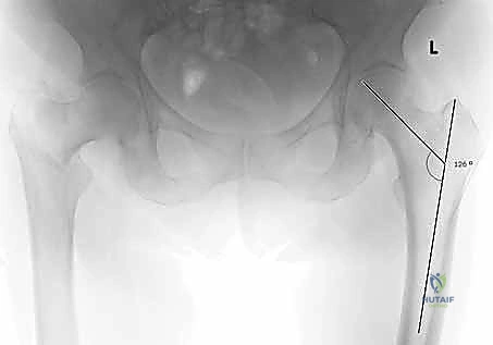 استخدام جهاز الأشعة داخل غرفة العمليات