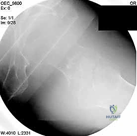 تجهيز الأدوات المعقمة