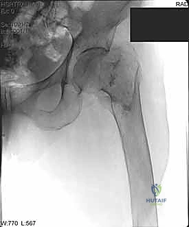 استخدام أدوات الحفر الجانبية