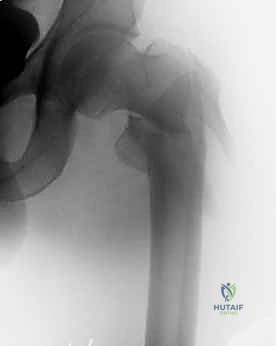 تثبيت الجزء السفلي من الشريحة