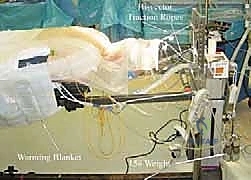 الخيارات العلاجية لآلام الرقبة