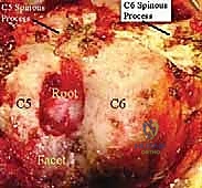 استعادة الحركة الطبيعية بعد الجراحة