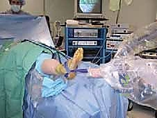 تآكل الغضاريف في مفصل الكاحل